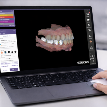 asi arrancamos el dia